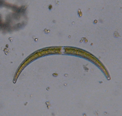 Microscopia delle acque astatiche del Bosco di Foglino